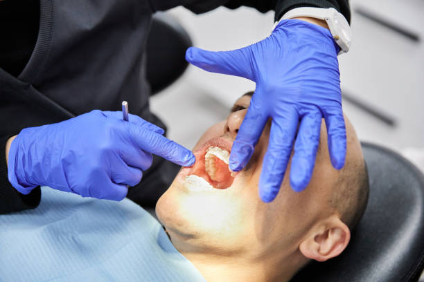 Best Emergency Denture Repair in Coralville, IA